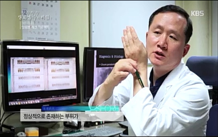 [670회] 생로병사의 비밀 - KBS670회] 생로병사의 비밀.ts_20220505_143151.466.jpg