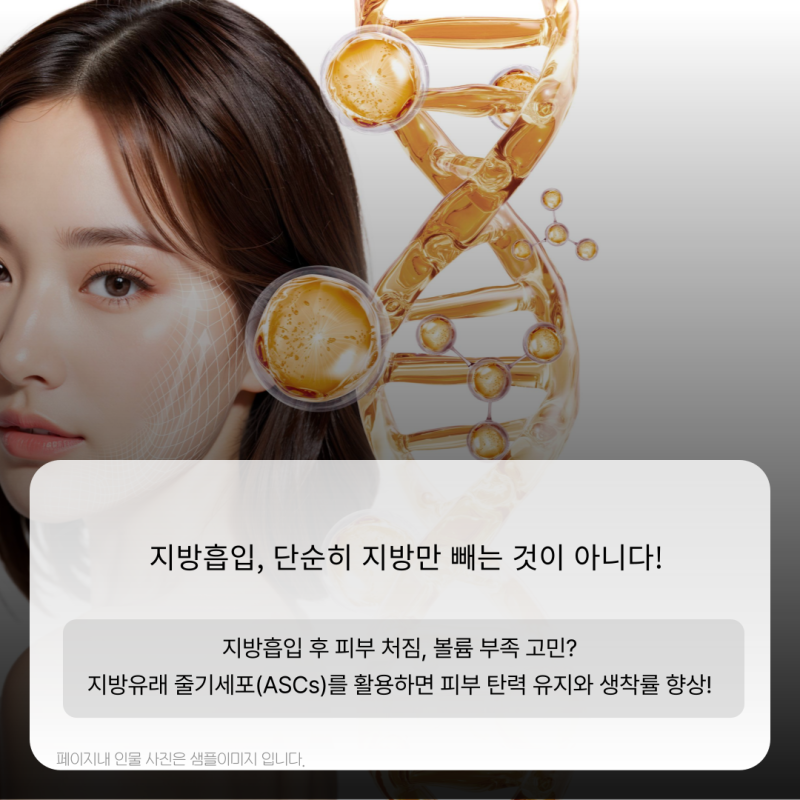 img 지방유래 줄기세포(ASCs)로 더 자연스럽고 효과적인 가슴성형과 지방흡입 시술!