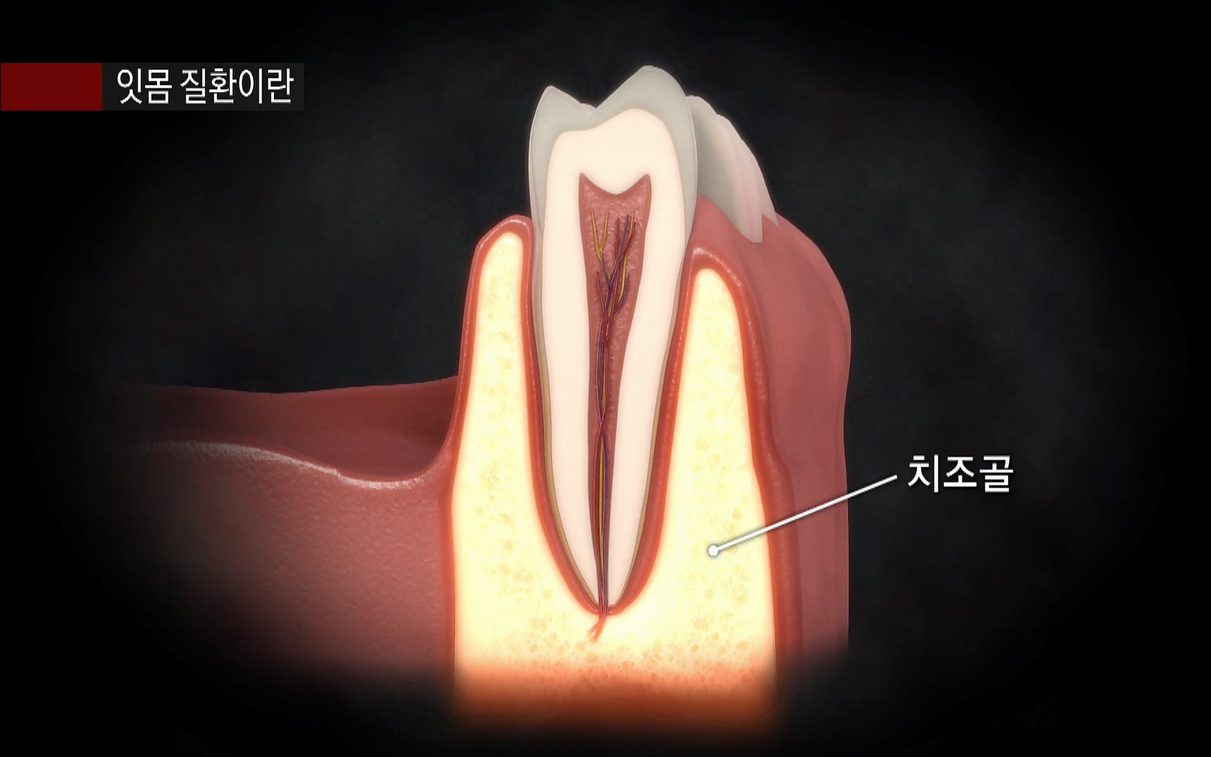 EBS 명의 헬스케어 - TV - 교육의 중심 EBS2015년 1월 16일 (금) 밤 9시 50분, EBS1.mp4_20220505_150353.960.jpg