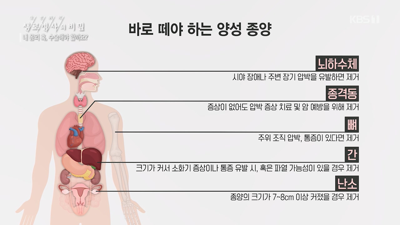 생로병사의 비밀.E870.230532p.H264-F1RST.mp4_20230605_201524.680.jpg