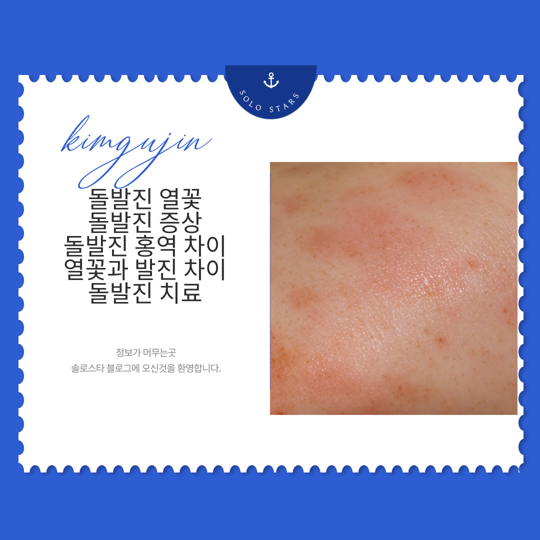 돌발진 열꽃 사진