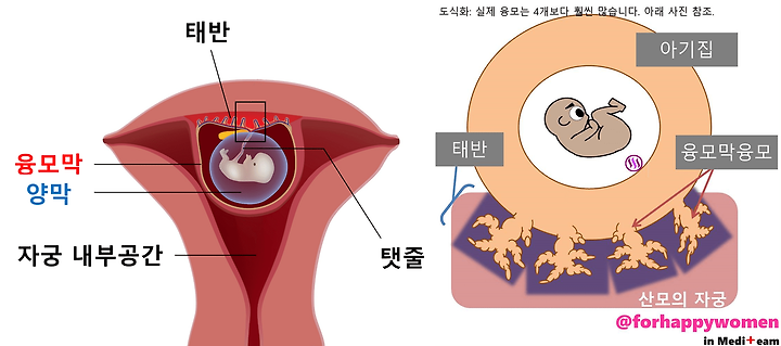 융모막검사 결과