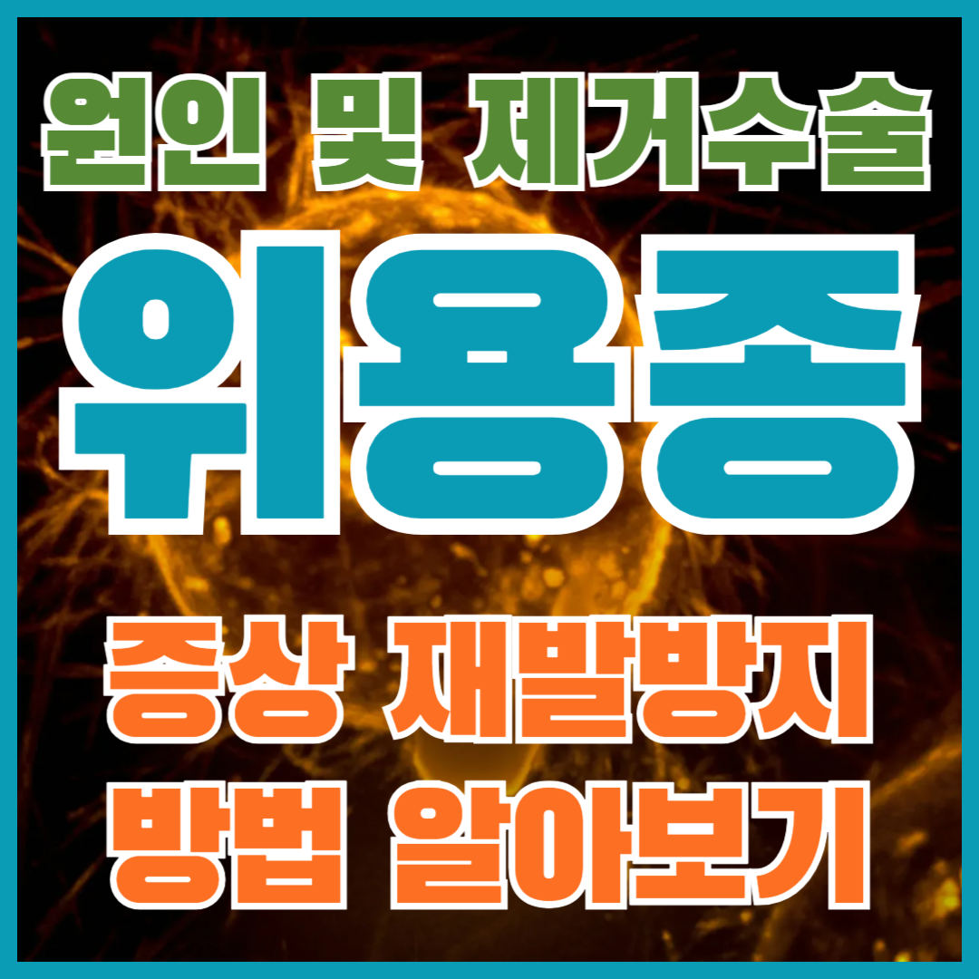 위 폴립,폴립,위 폴립 수술,위폴립이란,위버폴리스,폴립이란,위브폴,용종제거후 식사,용종제거 실비,용종제거,용종제거 술,용종 보험,용조아,담낭 용종,인천 용종동 아이비실용음악학원,대장용종,선종 용종,자궁용종,위 용종,대장용종제거,대장용종 조직검사,대장 선종 용종,대장 용종 종류,용종 뜻,대장용종제거후 식사,자궁내막 용종,대장내시경 용종제거 후 식사,과형성용종,용종제거 보험청구,쓸개 용종,용종과 선종의 차이,용종제거후 음주,용종제거 보험청구 서류,용종 선종,용종 제거후 음식,대장 용종,과형성 용종이란,용종 제거 술,용종 제거,용종 제거 후 식사,용종 영어로,용종 제거 후 라면,용종 제거 후 전복죽,용종 제거 후 고기,용종제거 비용,용종제거안하면,용종 증상,용종 제거 후 대변,용종제거 보험청구서류,담낭용종,대장용종제거 보험금,대장용종 선종,담낭 용종 제거수술비용,대장내시경 용종제거 보험비 청구,대장내시경 용종제거,대장 용종 제거 후 식사,대장 용종 제거 보험금 청구,담낭 용종에 금해야할음식,담낭용종 증상,대장용종 질병코드,십이지장 용종,대장 용종제거후 주의사항,대장 용종 크기,대장용종수술비보험,1회용 종이컵 용량,대장에 용종이 생기는 이유,담낭 용종 10mm 이상,담낭 용종 5mm,담낭용종에좋은음식,대장 용종 수술비,위용종제거,위용종 양성,위용종코드,위 용종,다발성 위용종,위 용종 조직검사,위 용종제거후 식사,위 용종제거 보험,위내시경 용종,위내시경 용종제거,위 용종 원인,위용종제거 보험,위내시경 용종 조직검사,위내시경 용종제거 보험,위 과형성용종,위 용종 보험,용종,위선종,위 종양,위용종 질병코드,위용종 코드,위 용종 암일확률,위 용종 제거수술,위 용종 제거후 보험금,위 용종 증상,위 용종 크기,위 용종 양성,위 용종 제거수술 보험,위 용종 제거후 음식,위 용종 제거후 음주,대장내시경 위내시경 용종 조직검사 보험금,위용종 원인,위용종 제거,위용종제거 비용,위용종 종류,위용종 제거 입원,위용종 조직검사,위용종절제술,위용종 제거 후 식사,위용종 분류,위용종 위암,위용종 가이드라인,위용종 endotoday,위용종 yamada,위용종 추적검사,위용종에좋은음식,위용종제거수술,위 용종 제거수술비용,위 용종 제거후 식사,위용종 사진,위용종 수술비,위용종제거 종수술비,위 용종이 생기는이유,위선종과 위용종 차이,위 용종제거
