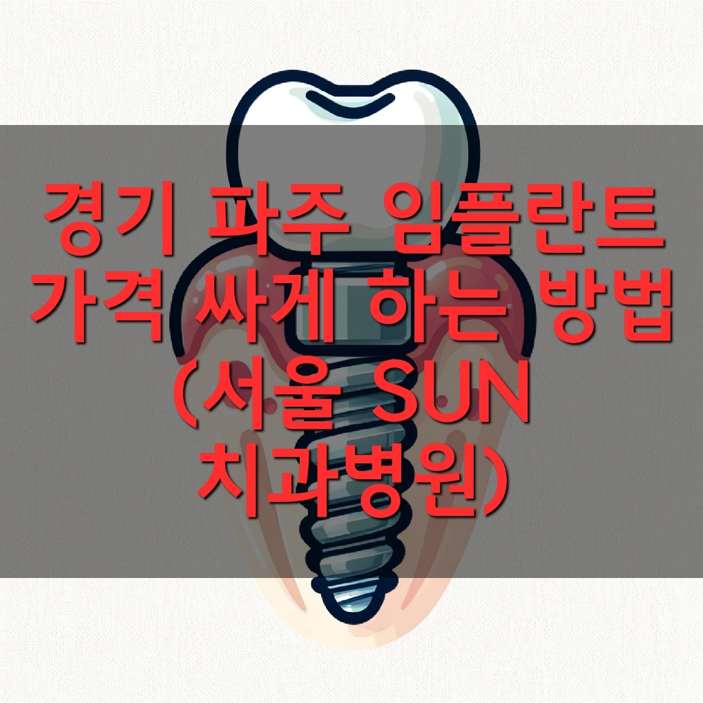 경기 파주 임플란트 가격 싸게 하는 방법