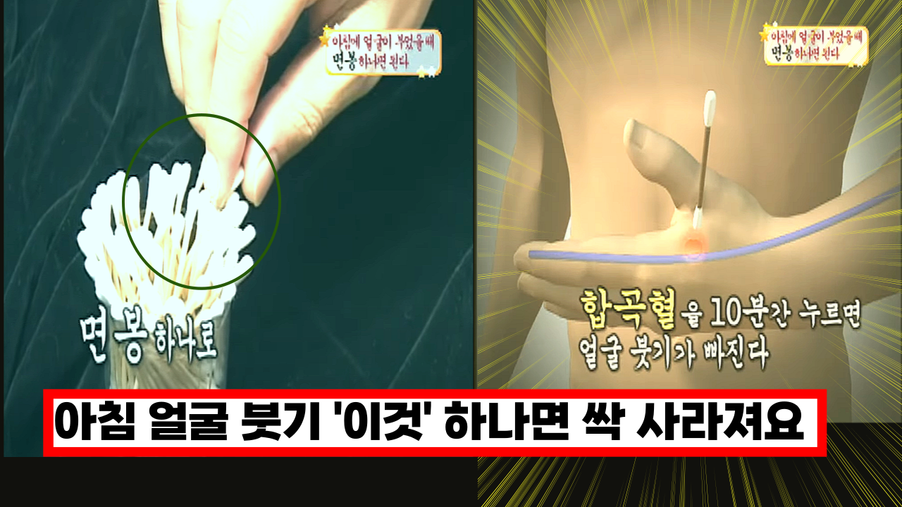  아침에 얼굴이 부었을때 '이것' 하나면 싹 사라집니다. 다른건 필요 없습니다.