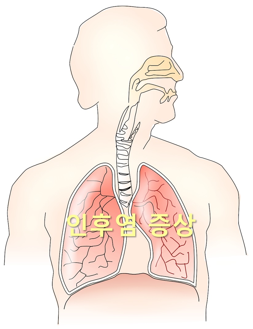  인후염 증상과 인후염 원인