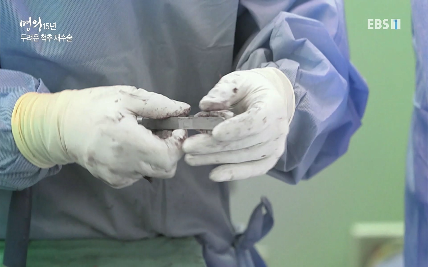 EBS 명의 헬스케어 - TV - 교육의 중심 EBS명의 15년 - 허리통증을 잡아라!.mp4_20220805_210308.492.jpg
