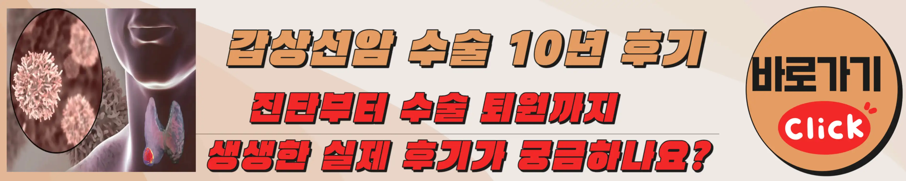 갑상선암 검사 방법 수술 후기