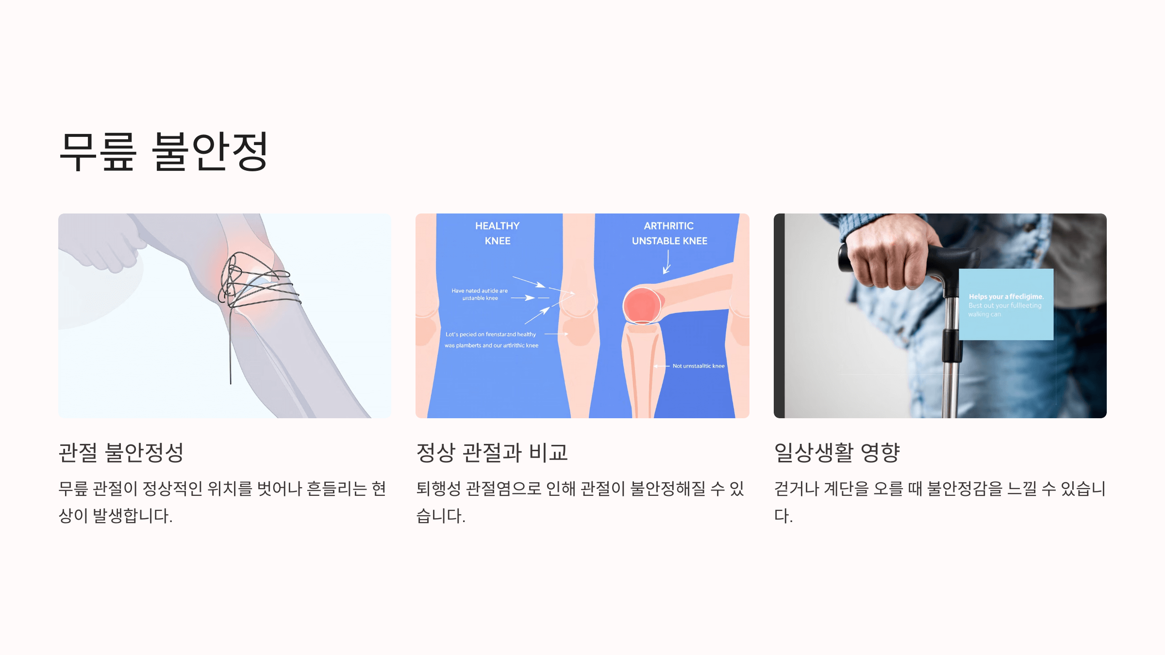 퇴행성 관절염과 관련된 사진입니다.