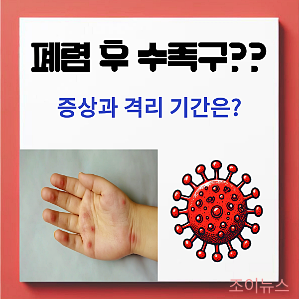 폐렴 후 수족구 발진? 증상과 격리기간은?