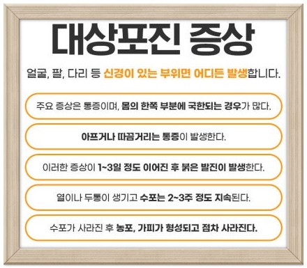 대상포진 증상