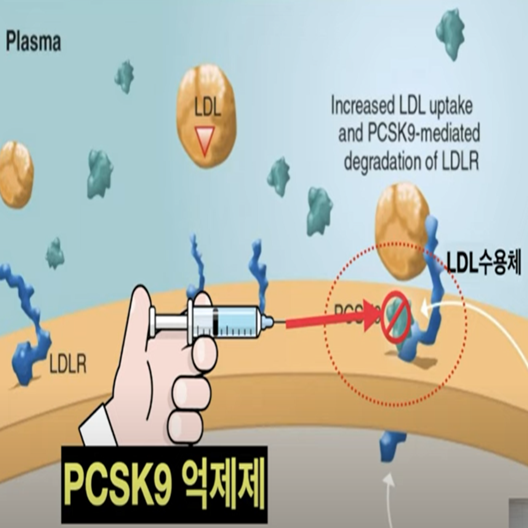  PCSK9 억제제 