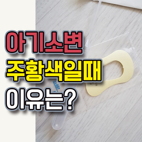 아기 주황색소변 이유는?