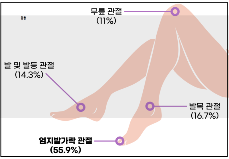 요산 배출 법-사진-1