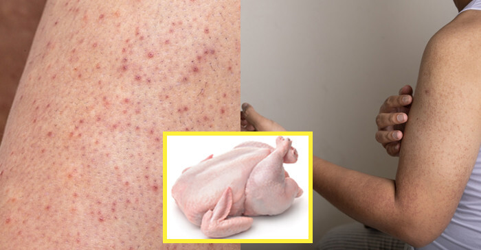  메디아하 스팟크림 피부 건조 각질 보습 마법의 크림으로 유명하다