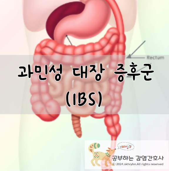 과민성 대장 증후군 (Irritable Bowel Syndrome, IBS)