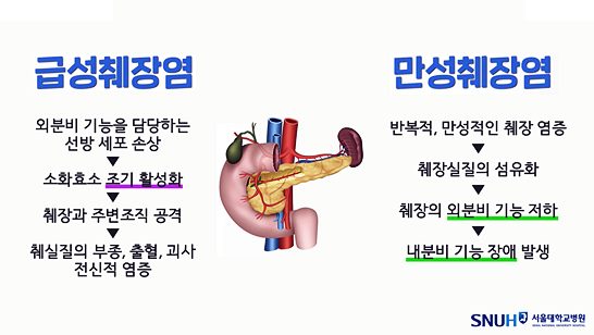 급성췌장염