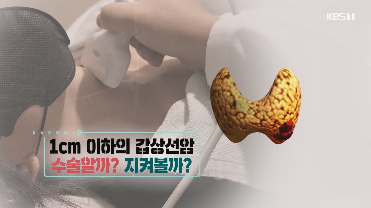 생로병사의 비밀.E894.231228p-NEXT.mp4_20231228_193052.773.jpg