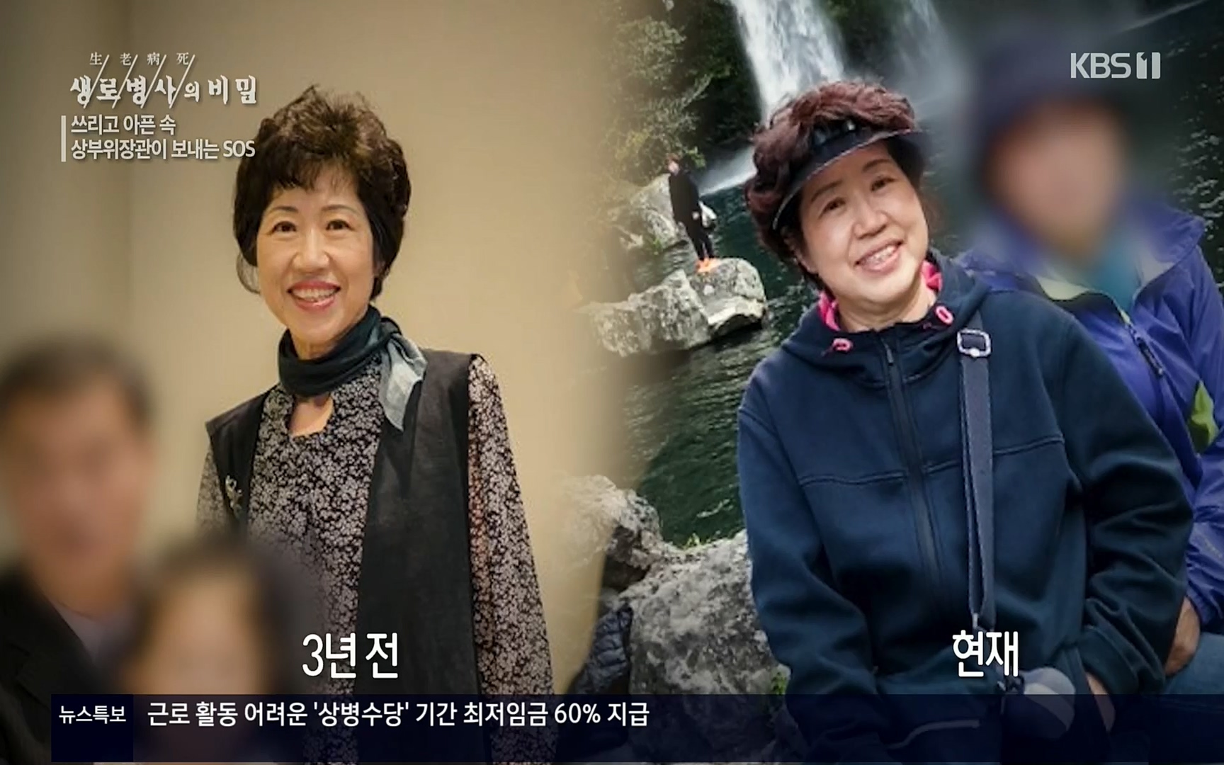 생로병사의 비밀.E822.220615p.H264-F1RST.mp4_20220616_203132.291.jpg