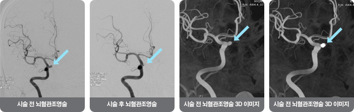 https://mjh.or.kr/main/healthMain/index.do?proc_type=view&amp;post_type=surgery&amp;midx=34&amp;prepage=%2Fmain%2FhealthMain%2Findex.do%3Fv_page%3D16