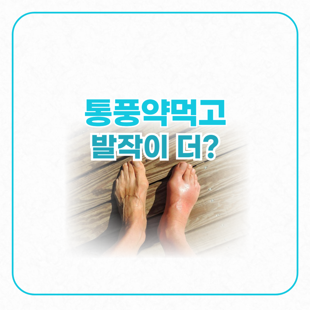 통풍약