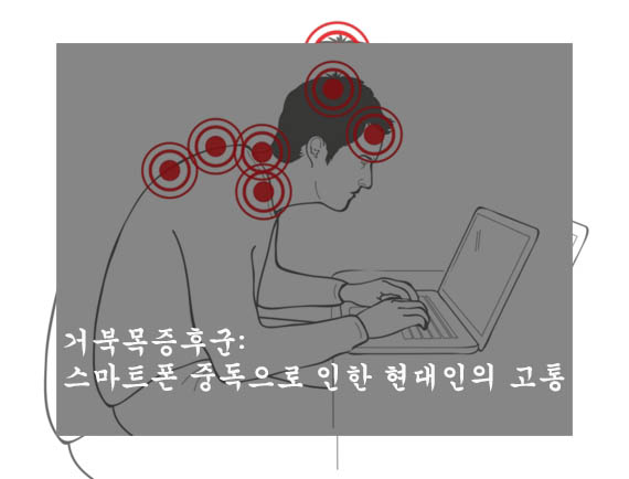  거북목증후군: 스마트폰 중독으로 인한 현대인의 고통