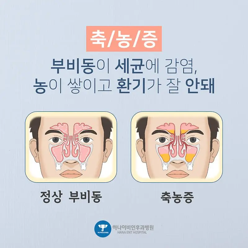  어금니 꽉 깨물면 귀가 아픈 이유: 축농증일까?