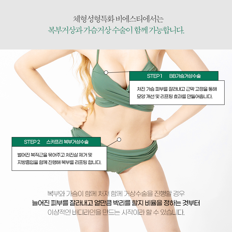 복부와 가슴이 처져 함께 거상수술을 진행할 경우
늘어진 피부를 잘라내고 얼만큼 박리를 할지 비율을 정하는 것부터 이상적인 바디라인을 만드는 시작이라고 할 수 있습니다.