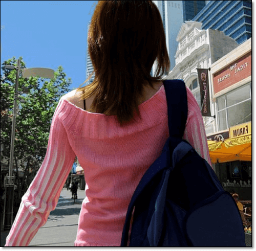  화농성 한선염 원인 및 치료 겨드랑이 화농성 한선염