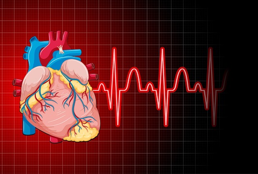 Angina-pectoris