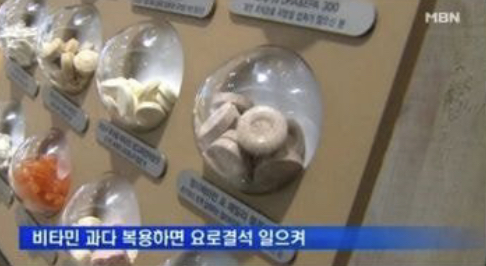  요로결석, 영양제 먹어서 생길 수 있음