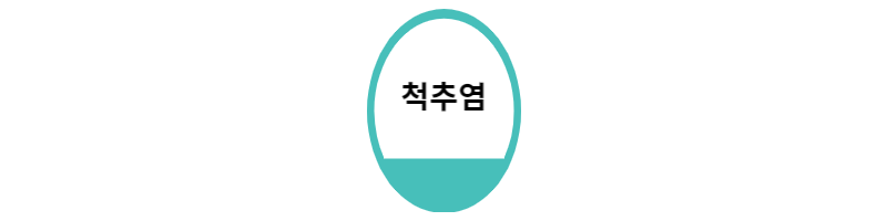  강직성 척추염 증상과 진행속도는 어떻게 될까?