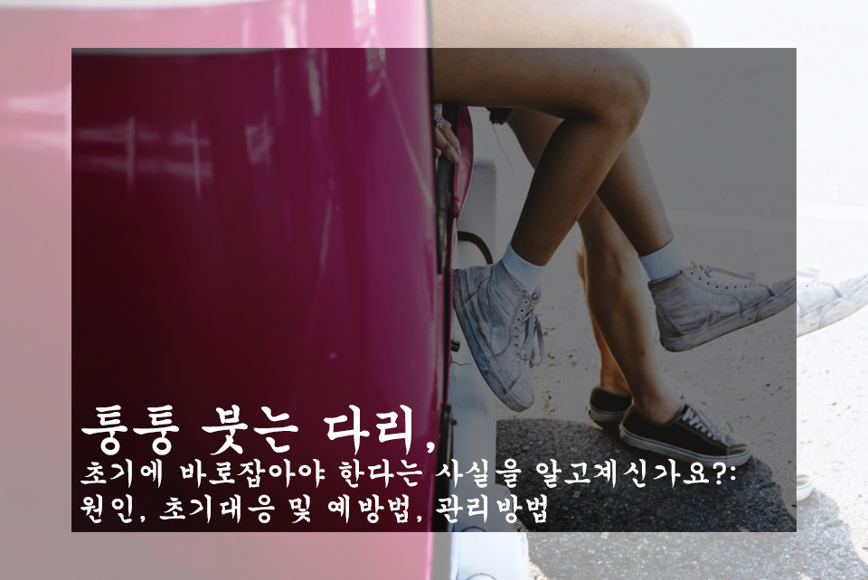  퉁퉁 붓는 다리, 초기에 바로잡아야 한다는 사실을 알고계신가요?: 원인, 초기대응 및 예방법, 관리방법