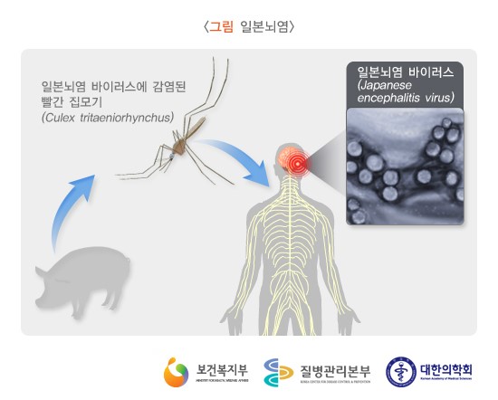  일본뇌염이란? 심각성 및 치료법 공개!
