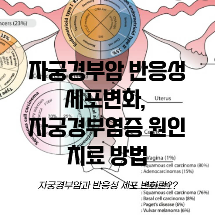 자궁경부암 반응성 세포변화 관련 썸네일