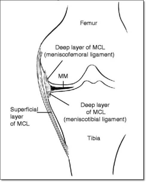 무릎 내측 측부 인대와 반월판의 연결성을 보여주는 그림