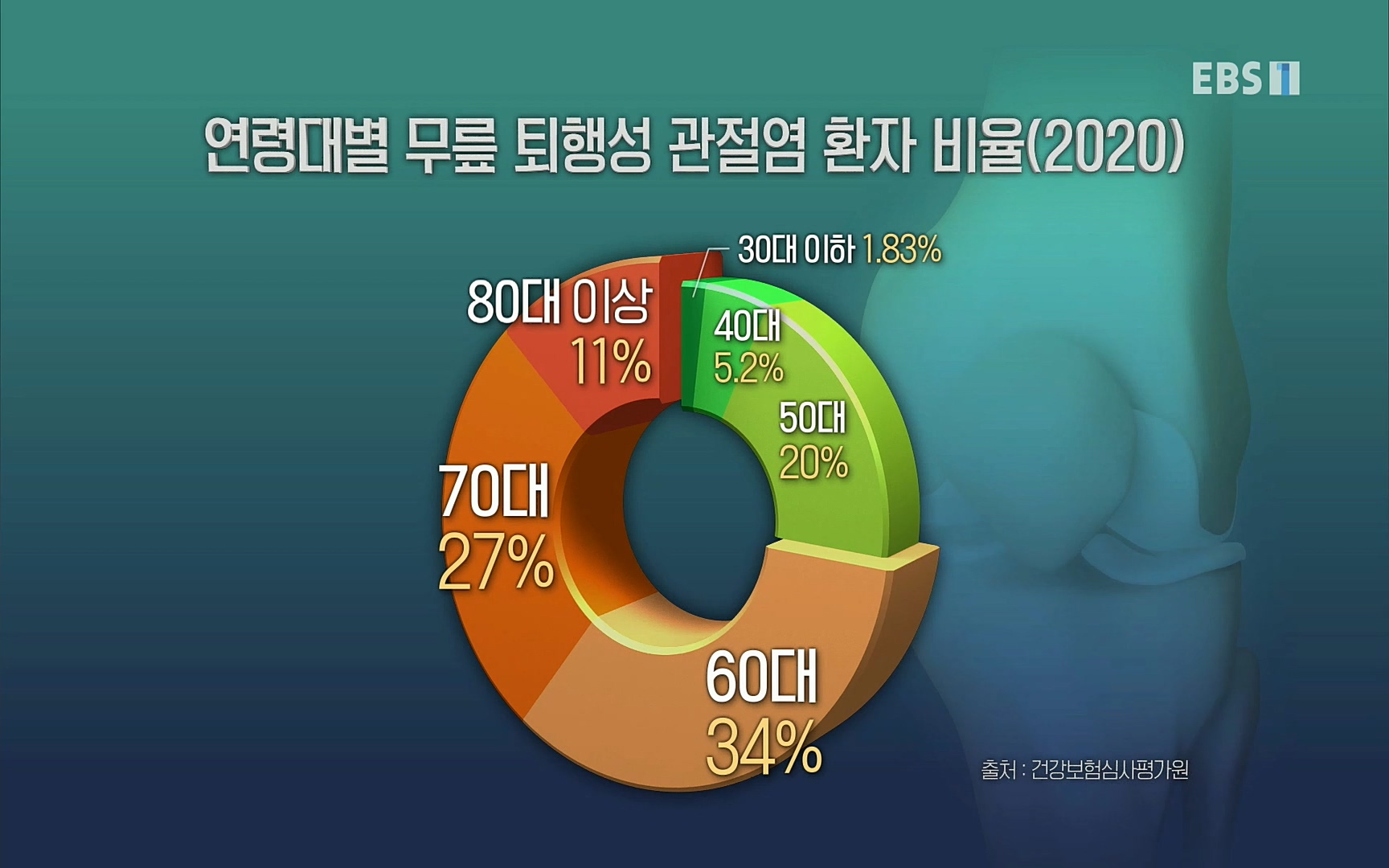 EBS 명의 헬스케어 - TV - 교육의 중심 EBS명의 15년 - 퇴행성관절염, 다시 걷는 사람들.mp4_20220803_212658.367.jpg