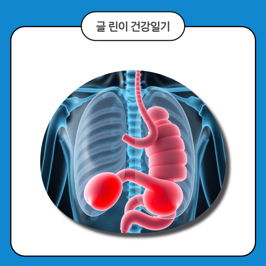 직장암 증상은?