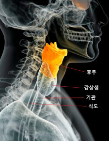  목구멍이 아파요. 역류성 후두염 의심해보세요