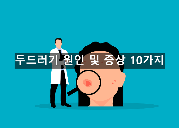  두드러기 원인 및 증상 10가지