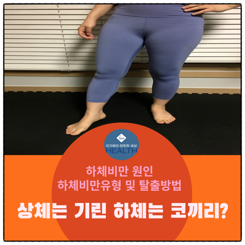  여자남자하체비만 원인,유형 및 탈출방법