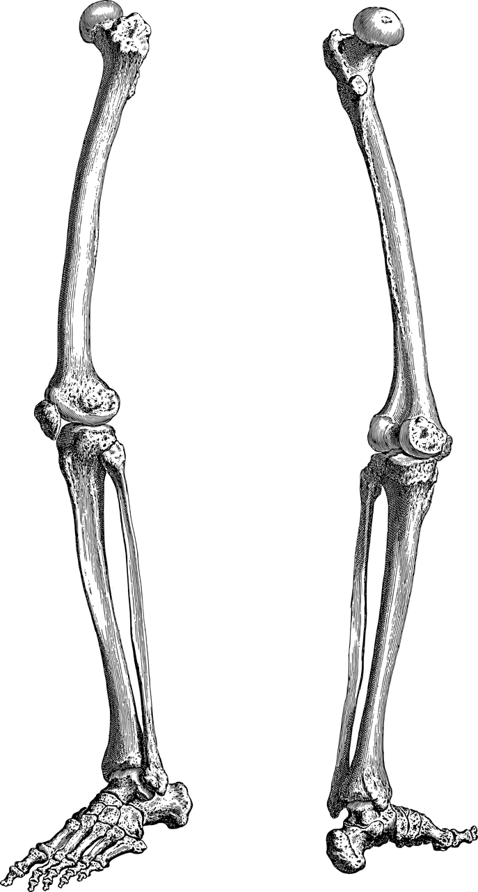 꼬리뼈 통증