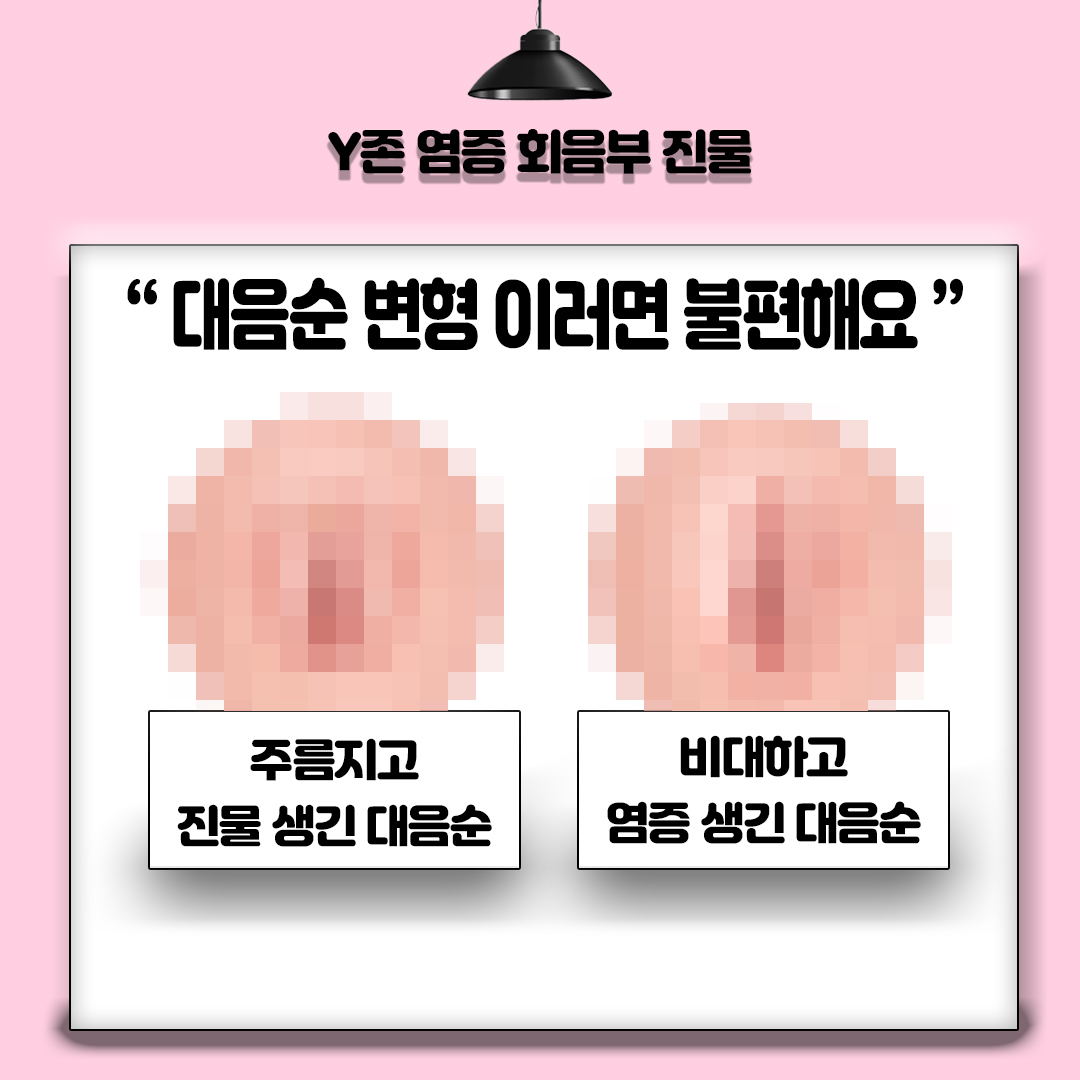 상현동 산부인과 Y존 염증 회음부 진물 어떤 대음순 모양이 불편할까요?