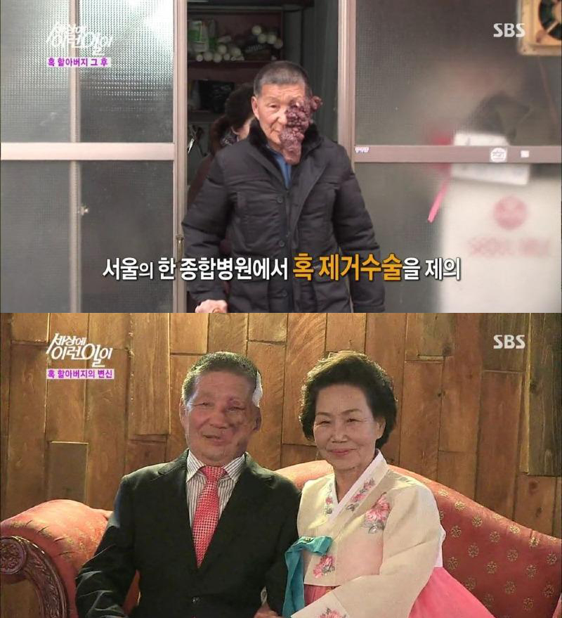  (세상에 이런 일이) 혹 할아버지 그후