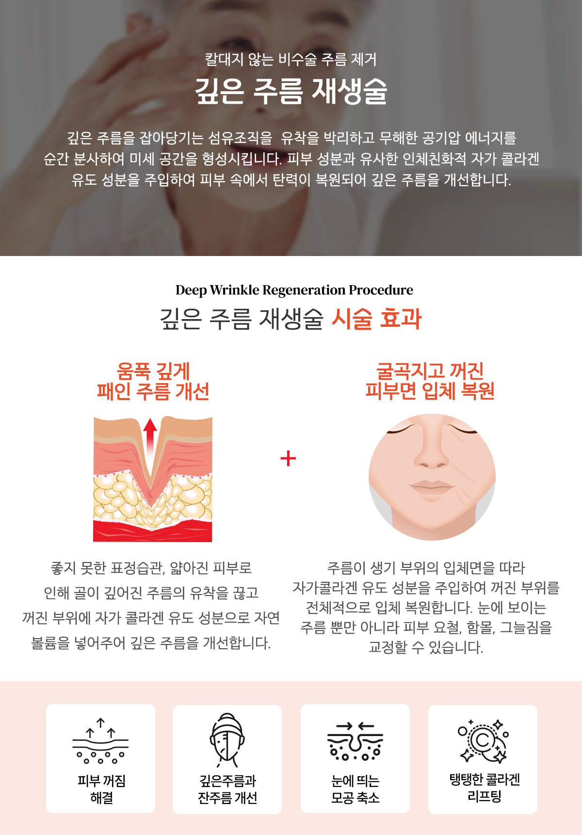 신사역 얼굴주름리프팅 (5).png