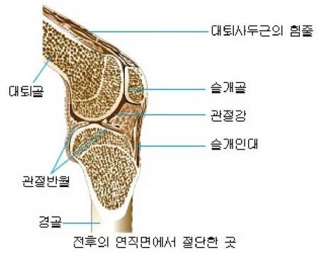 슬개골 골절