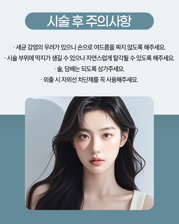 아그네스 이미지