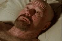 주름(wrinkles)