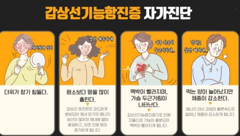 갑상선기능항진증_치료