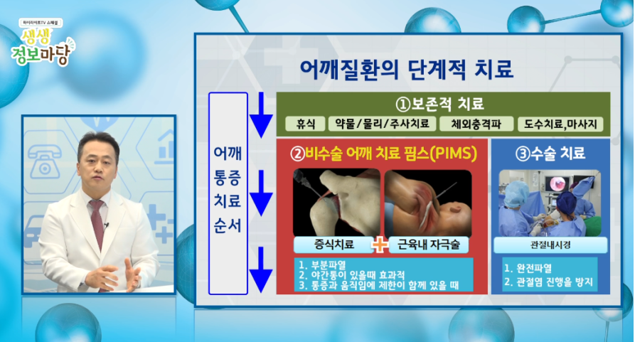  어깨 회전근개파열 수술하지 않고 간단한 비수술 치료방법